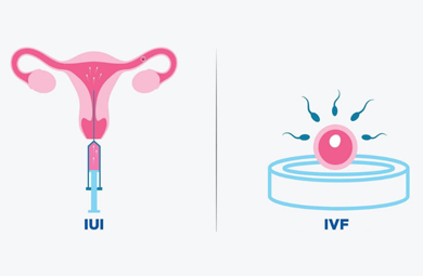 مراقبت&zwnj;های قبل از ivf و iui