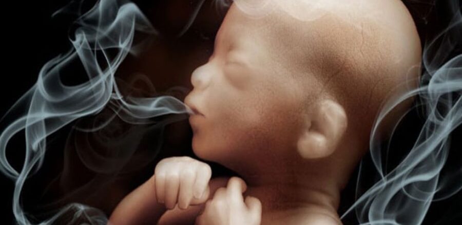 سیگار در بارداری