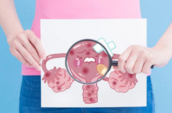 سرطان دهانه رحم