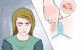 زگیل تناسلی در زنان